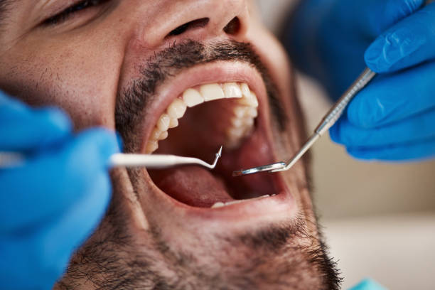 Dentist for Dental Trauma in KY