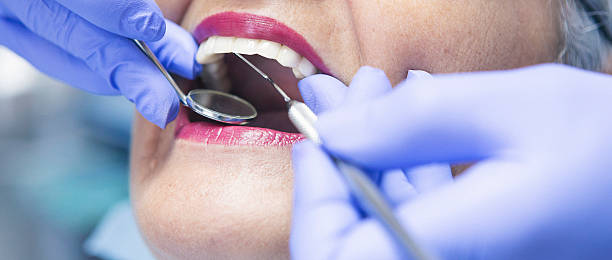 Best Chipped Tooth Repair Near Me  in Graymoor Devondale, KY